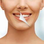 Wybielanie zębów – FAQ, czyli odpowiedzi na najczęstsze pytania